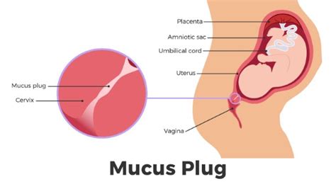 Top 9 Mucus Plug Vs Bloody Show 2022