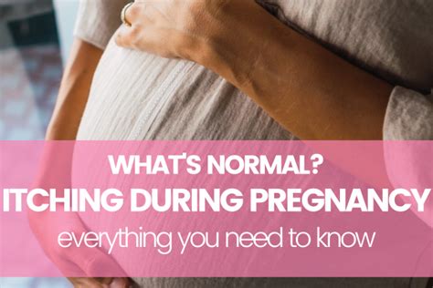Itching During Pregnancy Whats Normal And Whats Not