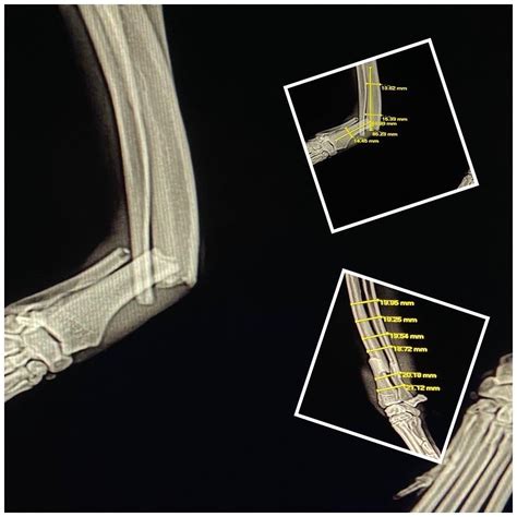 Plate Fixation Of Distal Diaphyseal Fracture In A Greyhound Dog