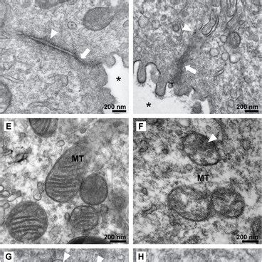 Diabetes insipidus is a rare condition that causes your body to make a lot of urine that is insipid, or colorless and odorless. Immunoblot Analyses of AQP2 from Mouse Kidneys (A) Western ...