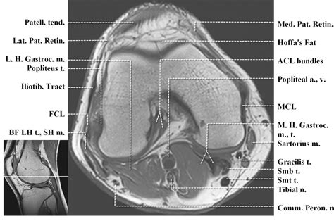 Knee Muscle Anatomy Mri Shoulder Mri Radiographical And