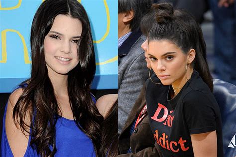 Women who performed such procedures would be branded as kendall jenner was born on november 3, 1995, in los angeles. Did Kendall Jenner Get Plastic Surgery? Model Calls ...