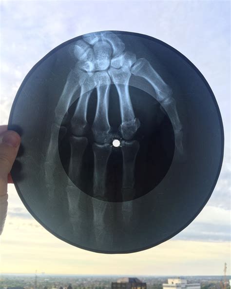 X Ray ‘bone Music Record Rvinyl