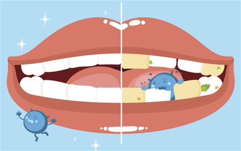 How Can Oral Bacteria Impact Your Pretty Smile