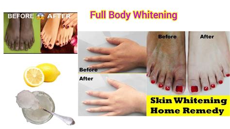 Effective Full Body Whitening At Home Guaranteed Result Youtube