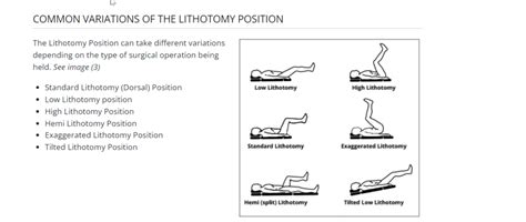 Lithotomy Position Phlebotomy Career Training