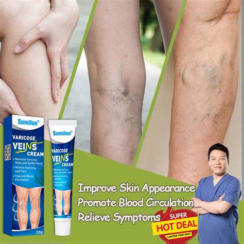 Sumifun Varicose Vein Remover Cream Treatment Varicosity Angiitis