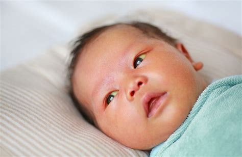 Mata Bayi Kuning Ini Penyebab Gejala Dan Cara Mengatasinya Catat