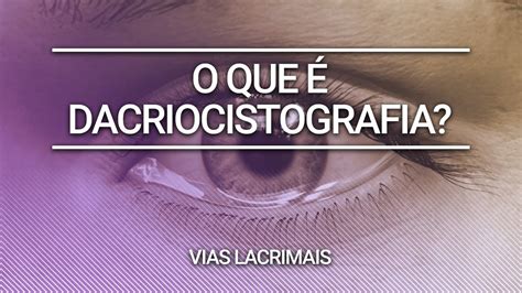 Dacriocistografia O Que é