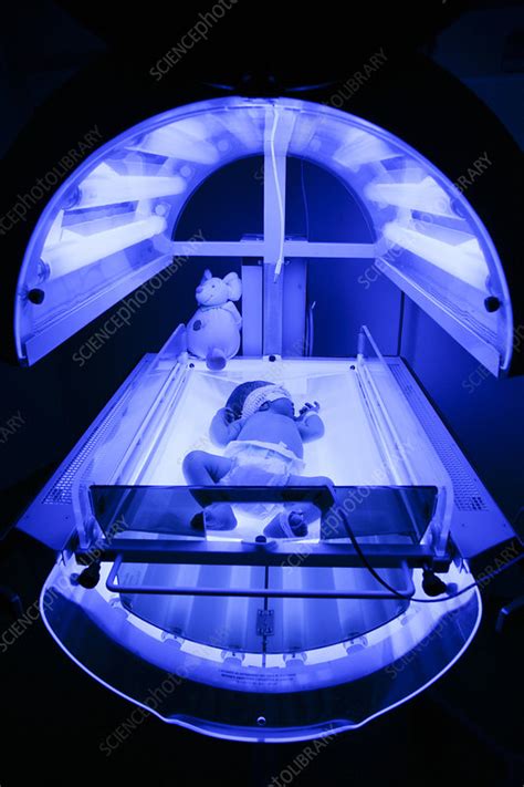 Neonatal Jaundice Phototherapy Stock Image C0063708 Science