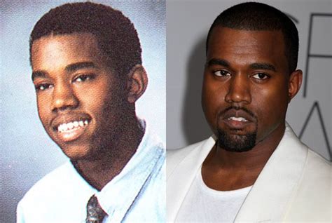 Kanye West Before Surgery