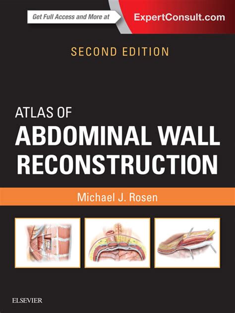Atlas Of Abdominal Wall Reconstruction Frohberg