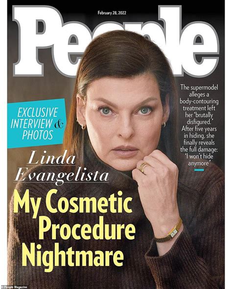 Linda Evangelista Poses For First Photoshoot Since She Was Left