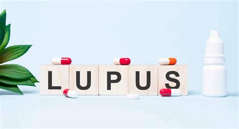 Sistemski Eritemski Lupus Uzrok Simptomi Liječenje Arzhr