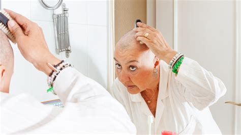 How To Regrow Hair On Bald Spot Treatments Coping And More
