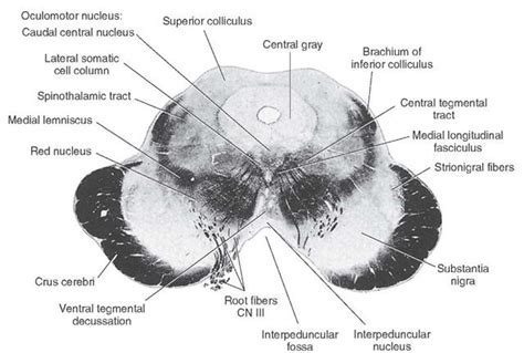 Photograph Of A Cross Section Taken At The Level Of The Superior