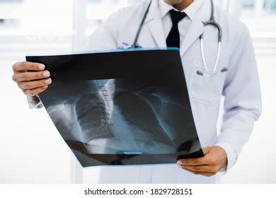 Doctor Radiological Chest Xray Film Medical Stock Photo