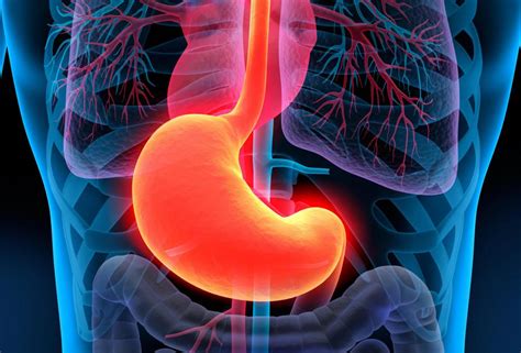 What Are The Gastric Cancer Stages With Picture