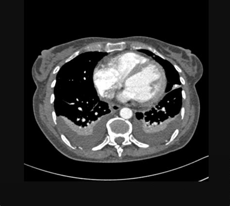 What Is A Ct Scan With Contrast Used For