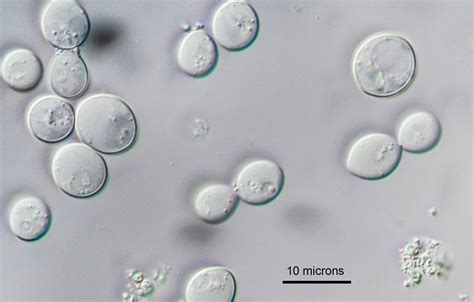Yeast Cells Under Microscope 40x