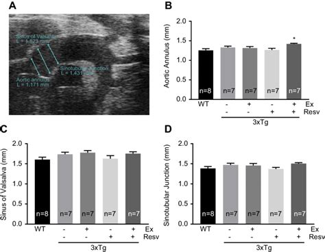 Measurements Of Aortic Root Diameters By Echocardiography Aortic Root