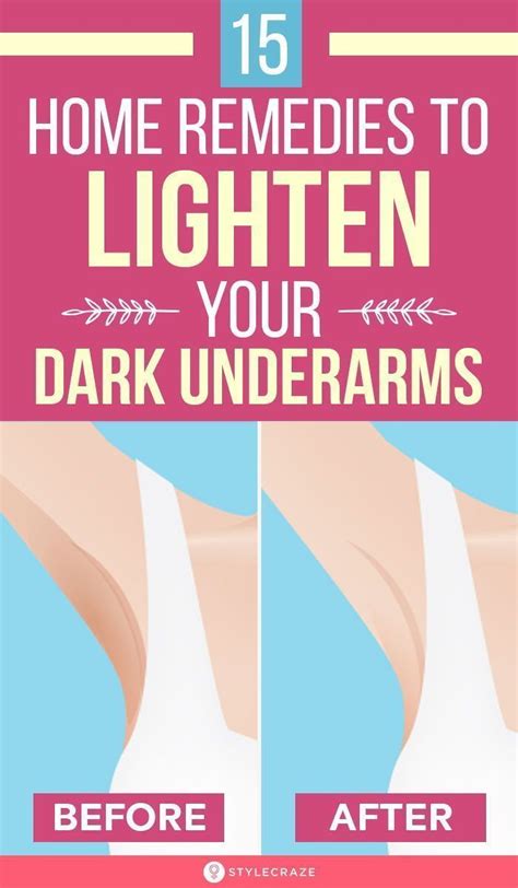 15 Home Remedies To Lighten Your Dark Underarms In 2021 Dark Underarms Dark Underarms Remedy