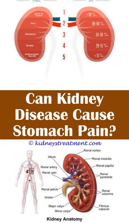 Pin On Kidney Infection Pain