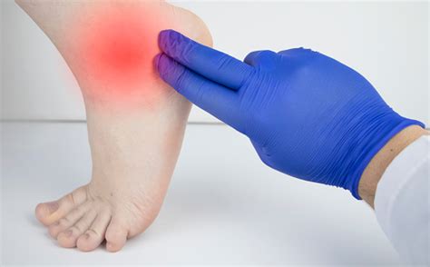 From pinched femoral nerve or meralgie paresthetica? An Orthopedic Doctor Examines A Womans Leg Heel Pain ...