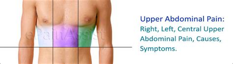 What Can Cause Upper Abdominal Pain