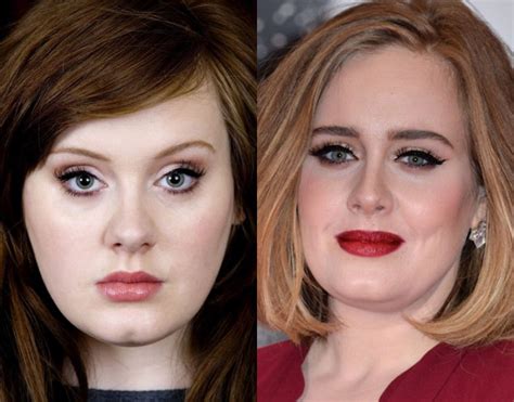 Does Adele Have A Nose Job Celebrity Surgery Before And After