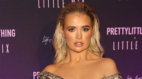 Love Island S Molly Mae Reveals She S Had Her Lip Fillers Dissolved Celebrity Heatworld