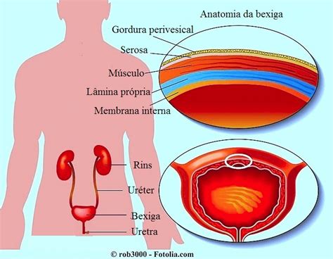 Dor Na Bexiga Ao Urinar E Infecção