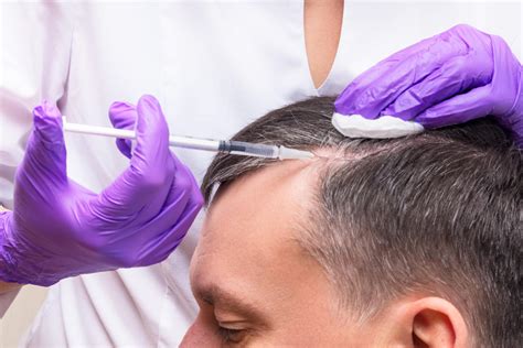 Using Your Own Plasma To Combat Hair Loss Yes And Here S What You Need To Know About Prp