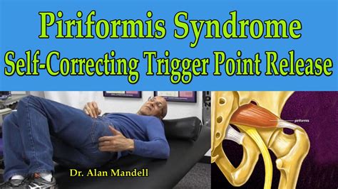 Piriformis Syndrome Self Correcting Trigger Point Release Dr