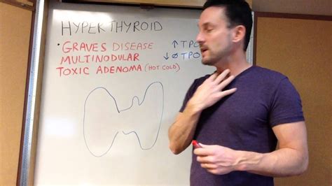 Hyperthyroid Graves Disease Multinodular Goiter Youtube