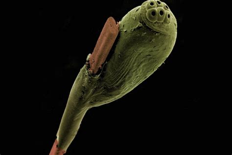 Head Louse Egg Attached To A Strand Of Hair Mind Blowing Images