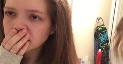 Video Reveals What Its Like To Have Bulimia