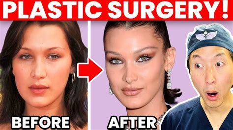 Plastic Surgeon Reacts To Bella Hadid Cosmetic Surgery Transformation