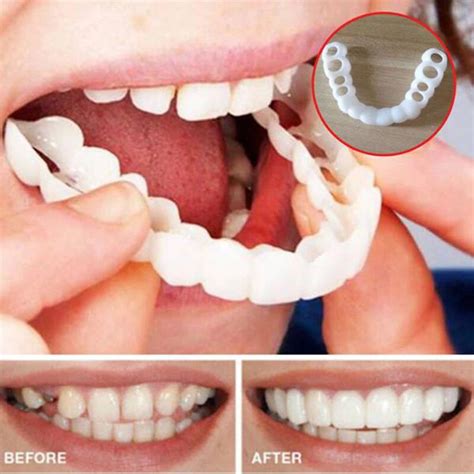 Beautiful Instant Dental Veneers Smile Comfort Fit Flex Cosmetic Teeth