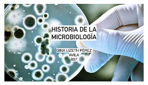 Historia De La Microbiología Timeline Timetoast Timelines