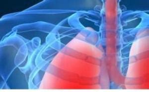 Bronquitis Respiratoria Enfermedad Pulmonar Intersticial Femexer