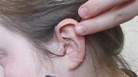 How To Insert Your Hearing Aid Youtube