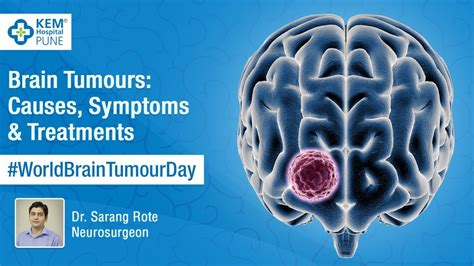 Brain Tumours Causes Symptoms And Treatments Youtube