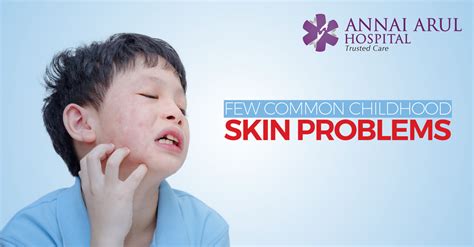 Few Common Childhood Skin Problems Multispeciality Hospitals In Chennai