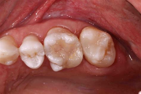 Img9865 Web Lee Ann Brady Dmds Dental Blog