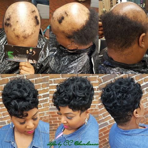 Full Crown Quickweave For Alopecia Client Protective Styles Alopecia