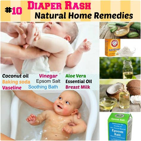 10 Home Remdies For Diaper Rash Nourishes And Protects Skin