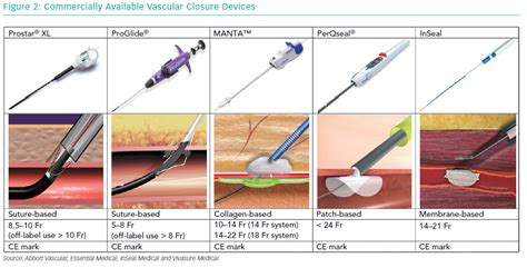 Large Bore Vascular Closure New Devices And Techniques Icr Journal
