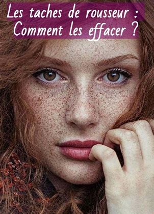 Les Taches De Rousseur Comment Les Effacer