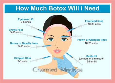 Botox How Much Will You Need Units And Dosage Explained Charmed Medispa